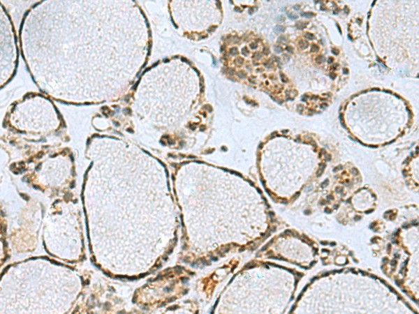 PTPA Polyclonal Antibody – Figure 1 of 2