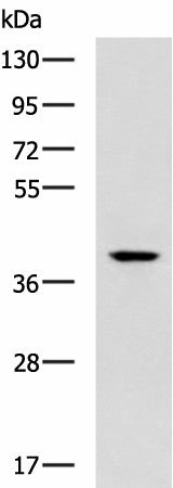 TDP2 Polyclonal Antibody – Figure 1 of 4
