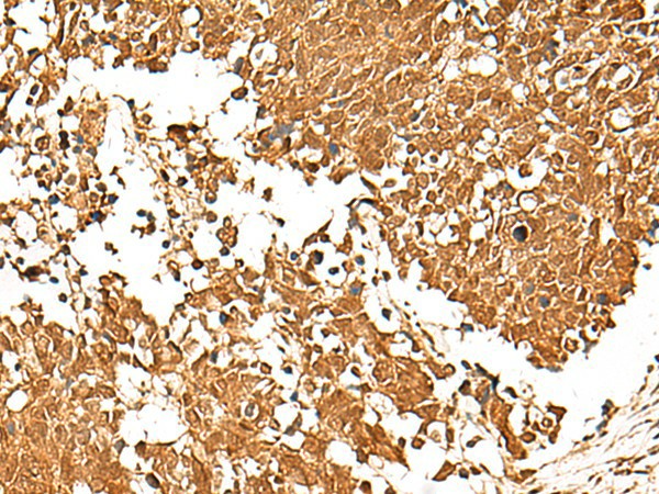 TCF7 Polyclonal Antibody – Figure 1 of 3