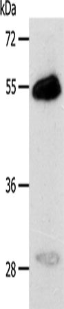 CA14 Polyclonal Antibody – Figure 1 of 2