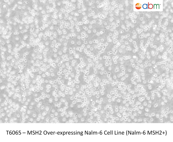 MSH2 Over-expressing Nalm-6 Cell Line (Nalm-6 MSH2+) | Applied Biological Materials (abm)