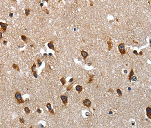LAMA1 Polyclonal Antibody – Figure 1 of 3