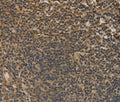 DACH1 Polyclonal Antibody – Figure 1 of 3