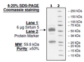 Sirtuin 5, GST-tag Recombinant – Figure 1 of 2
