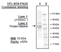 pf-HDAC1, Malaria, His-tag, FLAG-tag Recombinant – Figure 1 of 2