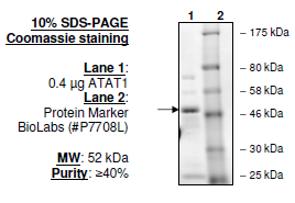 ATAT1, GST-tag Recombinant – Figure 1 of 1