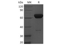 Recombinant Human PD-1/PDCD1 Protein (Fc Tag) – Figure 1 of 2
