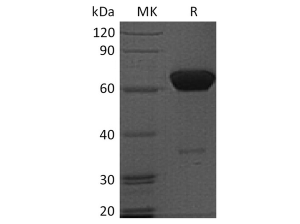 Recombinant Human PD-1/PDCD1 Protein (Fc Tag) – Figure 1 of 2