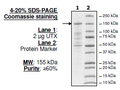 UTX (KDM6A), C-term FLAG-tag Recombinant – Figure 1 of 1