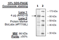 Mouse JARID1B (KDM5B, PLU-1), FLAG-tag Recombinant – Figure 1 of 1