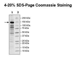 JMJD1A (KDM3A), FLAG-tag Recombinant – Figure 1 of 2