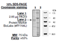 PADI3, FLAG-tag Recombinant – Figure 1 of 2