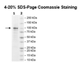 TET2, FLAG-Tag, His-Tag (catalytic domain) Recombinant – Figure 1 of 2
