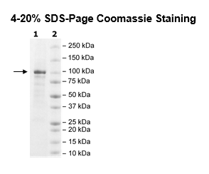TET2, FLAG-Tag, His-Tag (catalytic domain) Recombinant – Figure 1 of 2