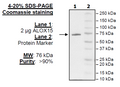 ALOX15, FLAG-tag Recombinant – Figure 1 of 2