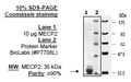 MECP2, GST-tag Recombinant – Figure 1 of 2