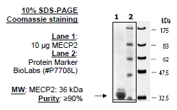 MECP2, GST-tag Recombinant – Figure 1 of 2