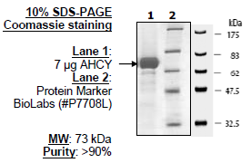 AHCY, GST-tag Recombinant – Figure 1 of 1