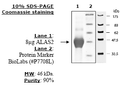 ALAS2, His-tag Recombinant – Figure 1 of 2