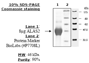 ALAS2, His-tag Recombinant – Figure 1 of 2