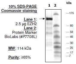 EZH2 (non-complexed), His-GST-tags Recombinant – Figure 1 of 1