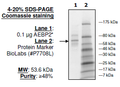 AEBP2, His-tag Recombinant – Figure 1 of 1