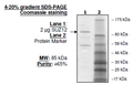 SUZ12, His-FLAG-tags Recombinant – Figure 1 of 1