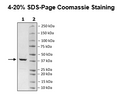 HSP40, His-tag Recombinant – Figure 1 of 1