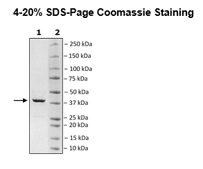 HSP40, His-tag Recombinant – Figure 1 of 1