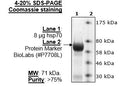 HSP70, His-Tag Recombinant – Figure 1 of 1