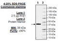 AHA1, His-tag Recombinant – Figure 1 of 2