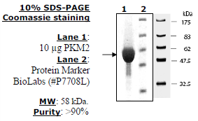 Mouse PKM2, His-Tag Recombinant – Figure 1 of 2