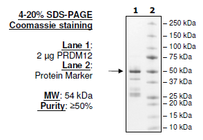 PRDM12, GST-tag Recombinant – Figure 1 of 1