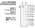 JMJD1B (KDM3B), FLAG-tag Recombinant – Figure 1 of 4