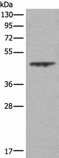 ASS1 Polyclonal Antibody – Figure 1 of 3