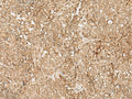 SNAPC5 Polyclonal Antibody – Figure 1 of 3