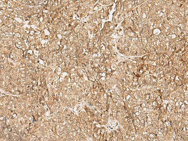 SNAPC5 Polyclonal Antibody – Figure 1 of 3