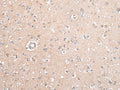 GJB5 Polyclonal Antibody – Figure 1 of 2