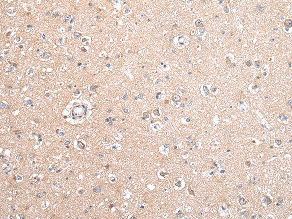 GJB5 Polyclonal Antibody – Figure 1 of 2