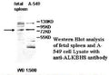 Anti-ALKBH8 Antibody – Figure 1 of 1