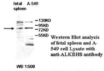 Anti-ALKBH8 Antibody – Figure 1 of 1