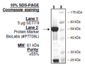 Set7/Set9, GST-tag (E. coli-derived) Recombinant – Figure 1 of 2