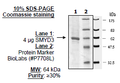SMYD3 (35-end), GST-tag Recombinant – Figure 1 of 1