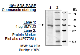 SMYD3 (35-end), GST-tag Recombinant – Figure 1 of 1
