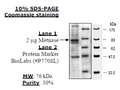 Metnase (SETMAR), FLAG-tag Recombinant – Figure 1 of 1