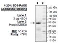NSD1, GST-tag Recombinant – Figure 1 of 2