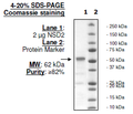 NSD2 (catalytic domain), GST-tag Recombinant – Figure 1 of 2