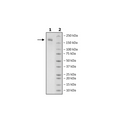 Spike Trimer (S1+S2) (B.1.351, Beta Variant), His-Tag (SARS-CoV-2) Recombinant – Figure 1 of 1
