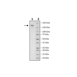 Spike Trimer (S1+S2) (B.1.351, Beta Variant), His-Tag (SARS-CoV-2) Recombinant – Figure 1 of 1