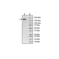 Spike Trimer (S1+S2) (B.1.1.7, Alpha Variant), His-Tag (SARS-CoV-2) Recombinant – Figure 1 of 1